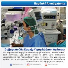 Goz Kapaklarinin Dogustan Birbirine Yapisik Olmasina Ankiloblefaron Adini Veriyoruz Goz Akinin Ustundeki Zarin Goz Kapaklarina Yapisiklikla Zara Bilgi Adlar