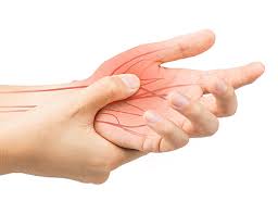 Le droit à réparation se fonde sur : Syndrome Du Canal Carpien Comme Maladie Du Travail