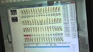 eaglesoft dental charting youtube