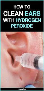 How To Clean Ears With Hydrogen Peroxide Ear Cleaning Ear Cleaning Wax Cleaning Ears With Peroxide