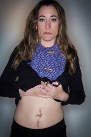 Unfortunately, because ovarian cancer is hard to detect and there is no widely used screening test. Cancer Gradworld Ovarian Cancer Day 2017