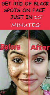 Pin On Skin Care