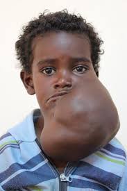 Healing the Children Northeast, Inc.