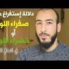 قد يواجه الشخص شعوراً بالغثيان بعدَ تناول الطعام وبالأخص إذا كانت لديه عدوى فيروسيّة في المعدة، وقد يحدُث الاستفراغ أيضاً أثناء حالات التسمم الغذائي، وانغلاق الأمعاء، والتهاب الزائدة الدودية، والصداع النصفي، والإصابة بجرثومة في المعدة. 1