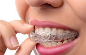 Check spelling or type a new query. Orthodontics Smith And Van Lierop Dentistry