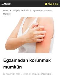 Toplumda Yaygin Olarak Gorulen Genellikle Eller Parmak Aralari Kollar Ve Sac Derisinde Ortaya Cikan Egzama Hastaligi En Cok Ev Kadinlarini Tehdit Ediyor Oze