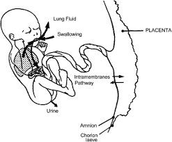 Amniotic Fluid Volume Too Much Too Little Or Who Knows