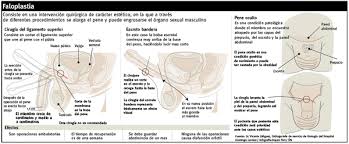 Oct 15, 2018 · a faloplastia é uma cirurgia que tem dois objetivos distintos: Infografia Cc Sur Twitter Faloplastia Un Procedimiento Para Elongar Y Engrosar El Pene Http T Co Ndstublo
