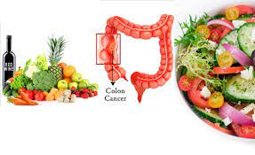 În topul produselor nesănătoase sunt floricelele la microunde. NutriÅ£ia Si Cancerul Colorectal Oncopedia Ro