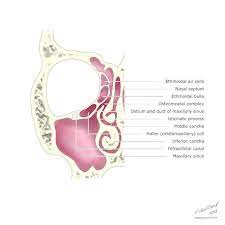 Haller Cells Radiology Reference Article Radiopaedia Org
