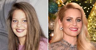 Did Candace Cameron Bure Get Plastic Surgery? Photos Then, Now