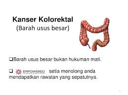 Bagaimana cara mencegah kanker usus besar? Persatuan Advokasi Kanser Malaysia Ppt Download