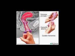 El condón femenino, pese a compartir las mismas funciones, difiere considerablemente del masculino. Todes Por El Condon Femenino Youtube