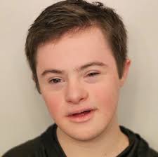 The Incredible Ryan Matheson