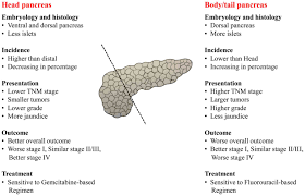 We did not find results for: Prognosis Of Distal Pancreatic Cancers Controlled By Stage
