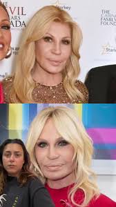 Before and after de #donatellaversace
