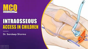 Image result for Intraosseous Access