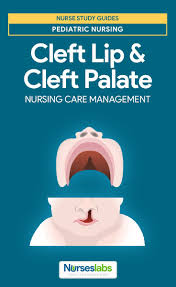 Cleft Lip And Cleft Palate Nursing Care Management Cleft Palate Cleft Lip And Palate Cleft Lip