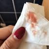 It may be clear, pink, or slightly bloody. 1