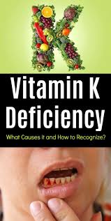 Vitamin K Deficiency What Causes It And How To Recognize Vitamin K Deficiency Vitamin K Vitamins