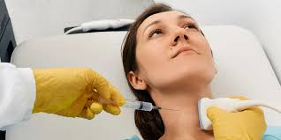 Missing First Screening Appointment Linked to Higher Risk of Breast Cancer  Death