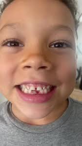 #heavyhands #heavydaddy #teeth #loosetooth #kidsoftiktok #shinyteethandme  #chipskylark