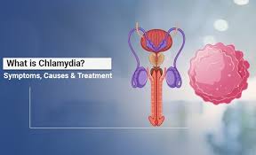 Image result for chlamydia symptoms