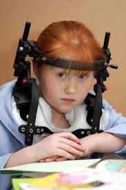 Robyn Mccullough 8 Robyn Suffered Broken Editorial Stock Photo