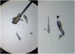 Image result for Demodex brevis