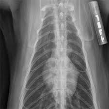 Abcde aproach in order to appreciate the anatomy within the chest cavity, it must be filled with air by having the. Imaging Anatomy