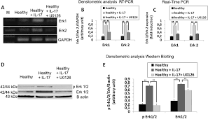 Image result for svrab na k%u016F%u017Ei