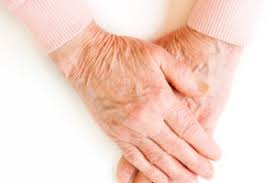 Moisturize as much as you can 3. Crepey Skin A Surprising Cause And 4 Expert Fixes Health Essentials From Cleveland Clinic