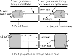 why should you use inert gas purging when welding stainless