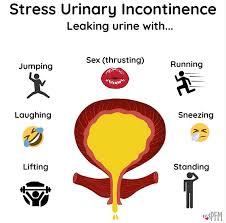 Image result for Stress Incontinence