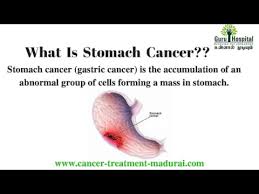 The symptoms, which can include an upset stomach and general stomach discomfort, are quite common and usually aren't related to. Stomach Cancer Treatment In Madurai Stomach Cancer Causes Stomach Cancer Cure Tamilnadu India Youtube