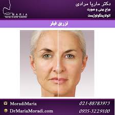 تزریق فیلر | تزریق فیلر بینی | تزریق فیلر چیست | تزریق فیلر هيالورونيک اسيد  | دکتر ماریا مرادی