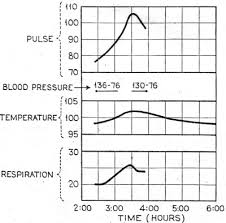 79 Methodical Pulse And Respiration Chart