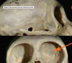 Solved 1 Bi A. Postorbital Bar And Postorbital Closure A | Chegg.Com