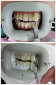 Taman connaught is one of the older areas of cheras and is a hot property area. City Dental Clinic Klinik Pergigian City In Taman Connaught Malaysia Read 2 Reviews