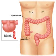 There are many organs in the body, more than seventy in total, so if we are to cover any ground in this article we'll want to limit them just to the major the kidneys come in a pair, much like the lungs. Is Your Appendix On The Left Side Or Right Side Of Your Body Socratic