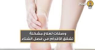 7 وصفات لعلاج مشكلة تشقق الأقدام في فصل الشتاء engagement engagement rings rings