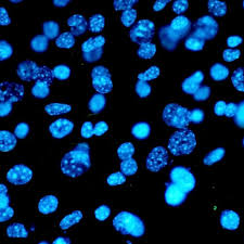 A systematic bias in generated datasets was recently shown for crispr and rnai gene silencing screens, 24 and for metabolic profiling of cancer cell lines. Cell Culture Experiments Protein Purification Dialysis Sartorius