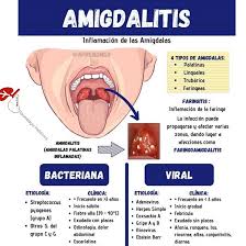 Las Amigdalas Son Unas Masas De Neumologia Pediatrica Facebook