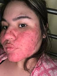 what are these and how to get rid of them? pleaseeeee