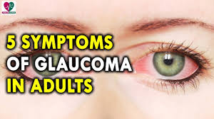 Glaucoma is one of the leading causes of blindness (above 60 years). Symptoms Of Glaucoma In Adults Best Health Tips For Eyes Youtube