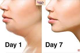 Get Jawline In 2 Weeks Without Jawline Exerciser Jawzrsize Gum Neck Double Chin Slimmer Remover Reducer Shaper Tool For Men Women Ebook Kumar As Amazon In Kindle Store