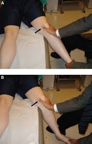 Image result for Patella Mobility Test