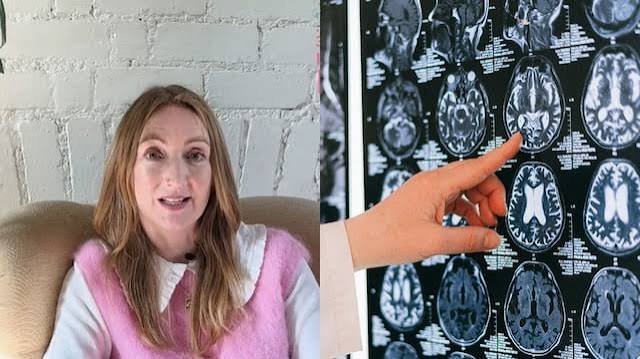 38 Parasites Found In UK Woman's Brain After Her Trip To India: What Is Neurocysticercosis?