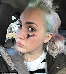 The Voice's Meghan Linsey opens up