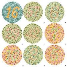 Color blindness (also called color vision deficiency or cvd) is a reduced ability to see colors. What Is An Ishihara Text Used For